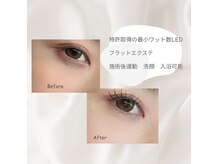 リンク(Link)の雰囲気（特許取得LEDライト使用でお客様のご負担を最小限に）