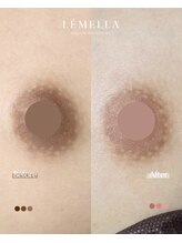 エルビービュティーサロン(LB BEAUTY SALON)/【ルメラ乳輪】実績数関西1★