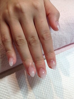 アクア ライズ 上大岡店(Aqua Rise)/深爪矯正　ナチュラル￥７９８０