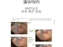 アミュール(AMYULE)の雰囲気（GREENPEEL コンテスト準グランプリ）