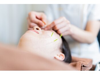 そね健康整骨院/【美容鍼】お肌のお悩みに！