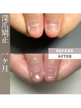 プリンチペッサジゼル/自爪育成 1ヶ月