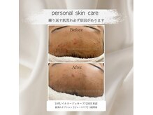メナードフェイシャルサロン 本山南の雰囲気（繰り返す肌荒れニキビの原因を根本から改善ケア）