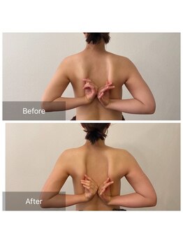 ベンザイ 梅田店(BENZAI)/産後の体、放置しないで