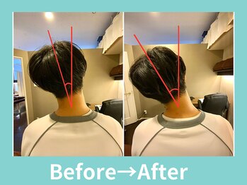 こころ整骨院/２0代男性のビフォーアフター