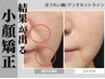 【EMS×小顔矯正】小顔矯正で理想のフェイスラインへ♪小顔矯正￥5,900