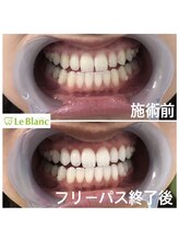 ルブラン 奈良店(Le Blanc)/綺麗な白い歯憧れませんか？