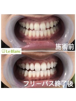 ルブラン 奈良店(Le Blanc)/綺麗な白い歯憧れませんか?
