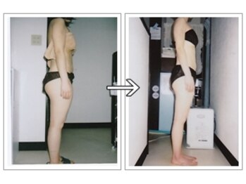 ルッチョラ(Lucciola)/ビフォーアフター