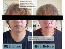 エン(EN。)の雰囲気（継続することで歪み改善や小顔効果、リフトアップ効果◎）