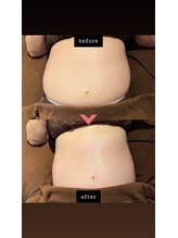 ナッティ(natti)/定期的なケアでサイズダウン！