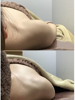 エミルカ 仙台(EMILUCA)/美姿勢＆美顔筋リフト