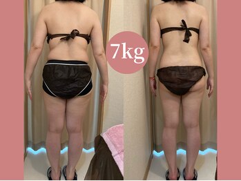 ハッテンビューティーパーク 神戸店(Hatten Beauty Park 810)/スリムムーヴ痩身