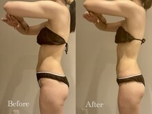 エステティック ミュー(Esthetic MiEUX)/ブライダル痩身