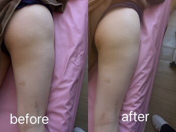 イーリバイブ/iNVYDOM MAX