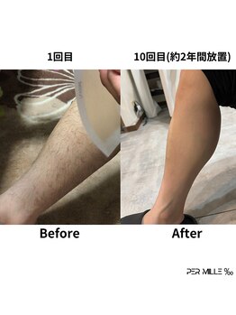 パーミル(per mille‰)/Before/After