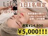 【5000円◇1日1名限定】超特別価格◆最新小顔マシン『Lifit』×小顔ラジオ波