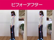 あい鍼灸院 接骨院 イオンタウン小阪院/ビフォーアフター