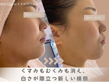 ビカオ(BIKAO)/ハーブピーリング