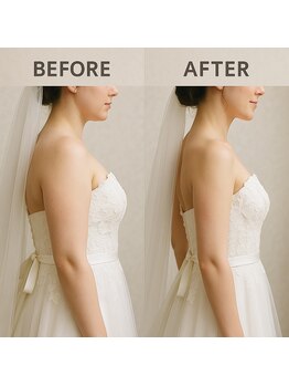 アプロ(Aphro)/花嫁二の腕スリム