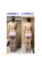 ヨサパーク ラブリエ 吉祥寺店(YOSA PARK La Briller)/ルルオン1回目でセル脂肪燃焼！