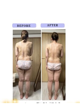 ヨサパーク ラブリエ 吉祥寺店(YOSA PARK La Briller)/ルルオン1回目でセル脂肪燃焼！