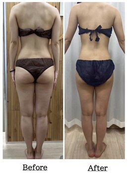 都度払いサロン Clear+ 泡瀬店【クリアプラス】脱毛/フェイシャル/痩身/バストケア/エルフィーノ痩身