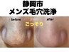 【メンズ本気毛穴】男の毛穴リセット×再発予防◎¥16,000→¥14,000
