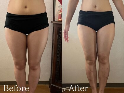 ボディーセオリー(bodytheory)の写真