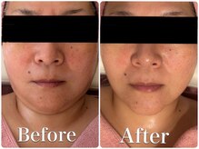 スイ 昭島店(Sui)の雰囲気（【肌質改善ハーブ×小顔リフト】即効で毛穴レスな上向き美肌へ）