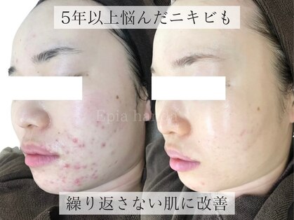 エピア 半田店(Epia)の写真