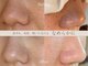 ベルエドゥース(Belle et Douce)の写真