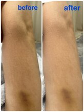 ナナラ(NANALA)/お顔だけじゃない！全身可能〇