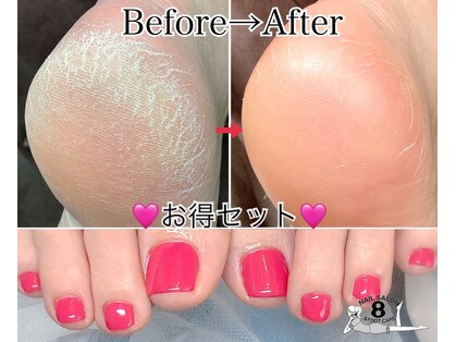 ネイルエイト 新百合ヶ丘(nail8)の写真