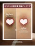6月だけbig event[1+1★メラニンケア♪]韓国でもNo.1☆ 乳輪170,000【80％】