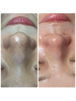 マリアム(mariam)/エクストラクション３回での結果