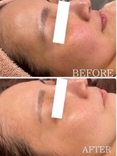 ブレス ザ モール郡山店(BLESS)/フェイシャル結果