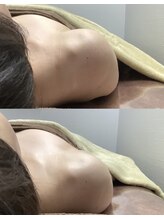 エミルカ 仙台(EMILUCA)/美姿勢＆美顔筋リフト