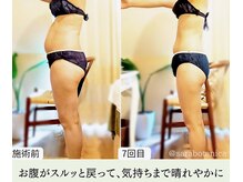 サラボタニカ 福岡博多の雰囲気（体型がみるみる美しく引き締まる　結果重視産後ボディメイク160）