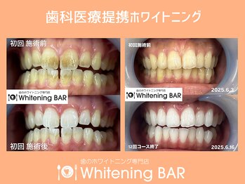 ホワイトニングバー 大宮店