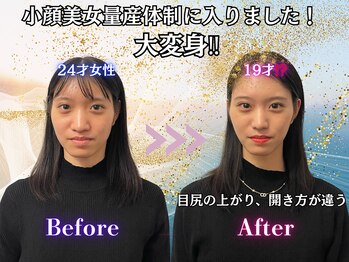 ミーアキャット 福岡天神(MEERKAT)/小顔美女量産体制