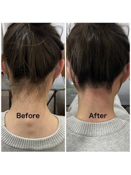 サロン ジプソ(salon Gypso.)/うなじダブル脱毛