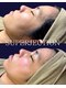 エスポワールカルド(Espoir caldo)の写真/ハリツヤUP！韓国VIP施術×高周波×SUPERJECTUONで輝く肌へ♪ナノチップ導入◎40文字
