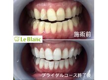 ルブラン 奈良店(Le Blanc)/ブライダルコース！