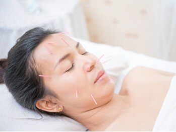 プラス(APLUS)の写真/痛みの少ない「優しい鍼」で小顔に♪リフトアップや肌質・くすみ改善にも☆美容鍼で内側から理想の小顔へ◎