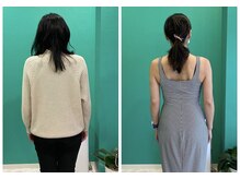 長年の猫背や骨盤原因の体の凝りや痛みお悩みは、美姿勢で改善へ