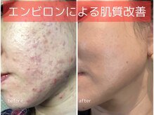 サロン ドゥメール(salon Demaile)