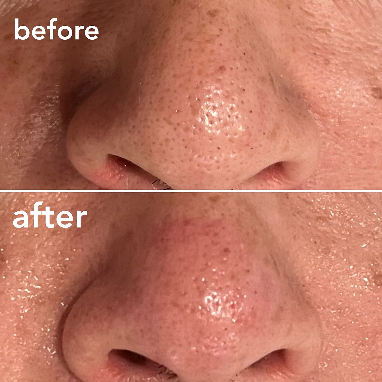 ゆるる(You*ruru)/黒ずみスッキリ肌へ