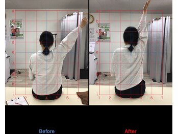 ストレチックス 近江八幡店/BeforeAfter