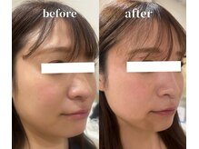 レアビューティー(Le'a beauty)/サーマトリックス×レモンボトル